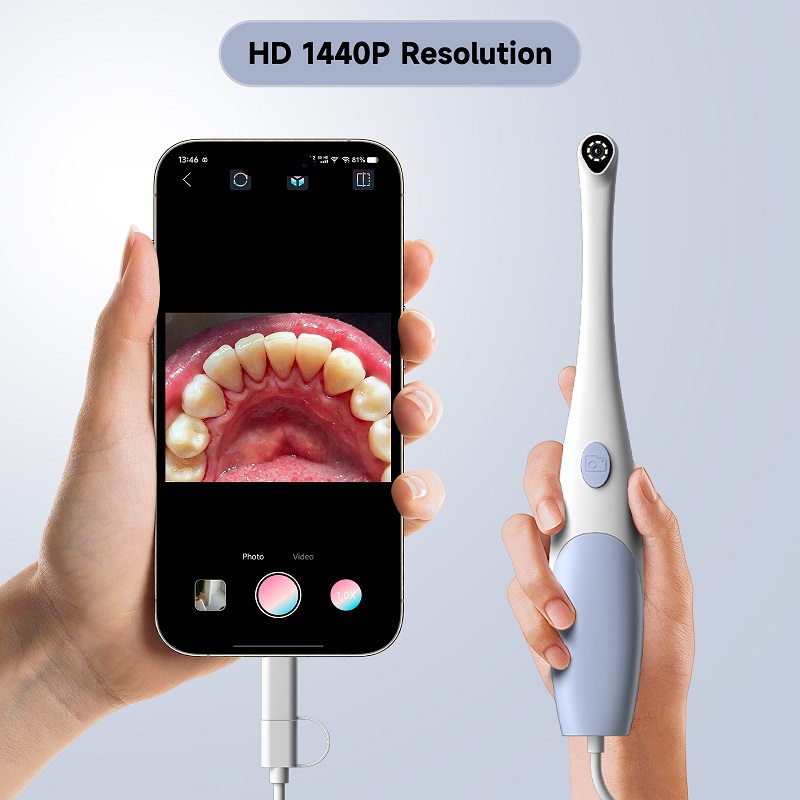 Kamera Endoskop Oral 1440P Fot - Photography Lighting Diagram ulasan dan harga