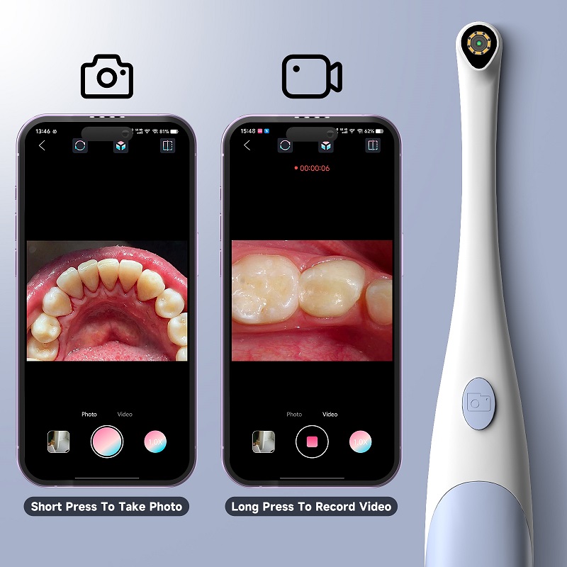 Kamera Endoskop Oral 1440P Fot - Photography Lighting Diagram ulasan dan harga